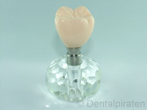 Dental Implantatmodell